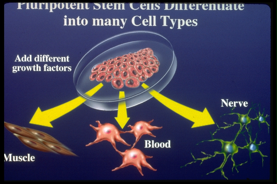 Stem Cell Therapy (Terapi Sel Induk) Pada Autisme || Autisme ABA Applied Behavior Analysis Lovaas Indonesia Jakarta Bekasi 